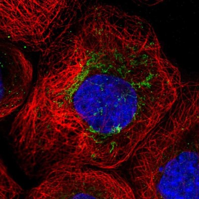 Immunocytochemistry/Immunofluorescence: ANKRD34C Antibody [NBP2-33442] - Immunofluorescent staining of human cell line A-431 shows localization to mitochondria.