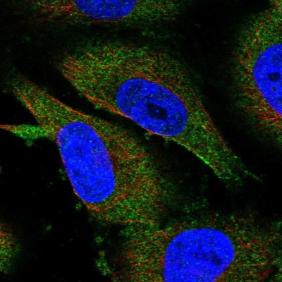 Immunocytochemistry/Immunofluorescence: METTL13 Antibody [NBP1-92109] - Immunofluorescent staining of human cell line U-251 MG shows localization to cytosol.