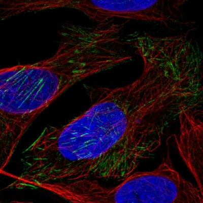 Immunocytochemistry/Immunofluorescence: LSM6 Antibody [NBP1-92083] - Immunofluorescent staining of human cell line U-2 OS shows localization to actin filaments.