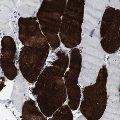 Immunohistochemistry: Muscarinic Acetylcholine Receptor M5/CHRM5 Antibody [NBP1-87578] - Staining of human skeletal muscle shows strong cytoplasmic positivity in myocytes.