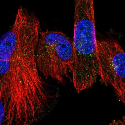 Immunocytochemistry/Immunofluorescence: CHST11 Antibody [NBP2-30481] - Immunofluorescent staining of human cell line U-251 MG shows localization to the Golgi apparatus.