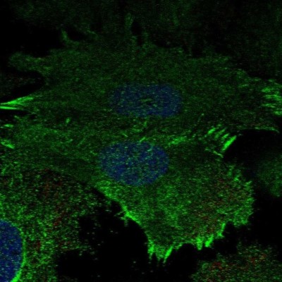 Immunocytochemistry/Immunofluorescence: Aquaporin-5 Antibody [NBP2-39043] - Staining of human cell line SiHa shows localization to plasma membrane.