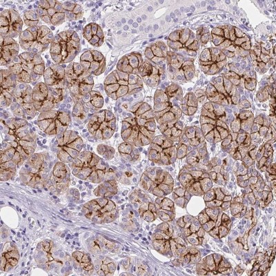 Immunohistochemistry: Aquaporin-5 Antibody [NBP2-39043] - Staining of human salivary gland shows strong membranous positivity in glandular cells.