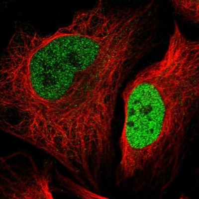 Immunocytochemistry/Immunofluorescence: SUV420H2 Antibody [NBP2-30524] - Immunofluorescent staining of human cell line U-2 OS shows localization to nucleoplasm.
