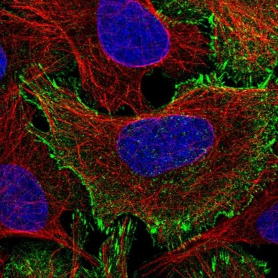 Immunocytochemistry/Immunofluorescence: C19orf21 Antibody [NBP2-14390] - Staining of human cell line U-2 OS shows positivity in plasma membrane & focal adhesion sites.