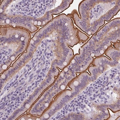 Immunohistochemistry-Paraffin: C19orf21 Antibody [NBP2-14390] - Staining of human small intestine shows strong membranous positivity in glandular cells.