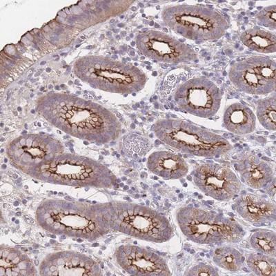 Immunohistochemistry-Paraffin: C19orf21 Antibody [NBP2-14390] - Staining of human stomach, lower shows strong membranous and cytoplasmic positivity in glandular cells.