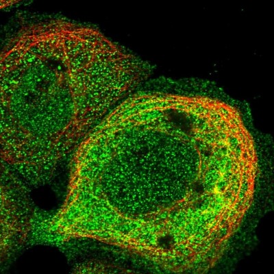 Immunocytochemistry/Immunofluorescence: TRPM4 Antibody [NBP2-13487] - Immunofluorescent staining of human cell line A-431 shows localization to nucleoplasm & plasma membrane.