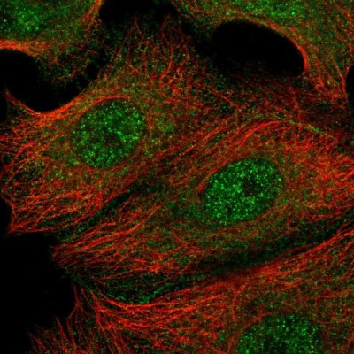 Immunocytochemistry/Immunofluorescence: Prominin 2 Antibody [NBP2-38032] - Staining of human cell line MCF7 shows localization to nucleoplasm & plasma membrane.