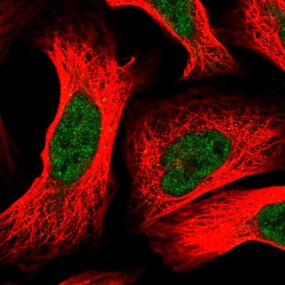 Immunocytochemistry/Immunofluorescence: DDB1 Antibody [NBP2-38538] - Immunofluorescent staining of human cell line U-2 OS shows localization to nucleoplasm.