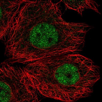 Immunocytochemistry/Immunofluorescence: C20orf175 Antibody [NBP2-30556] - Staining of human cell line MCF7 shows localization to nucleoplasm.
