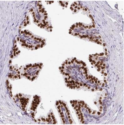 Immunohistochemistry: C20orf175 Antibody [NBP2-30556] - Staining of human prostate shows strong nuclear positivity in glandular cells.
