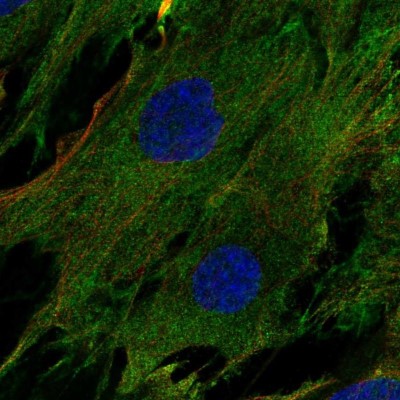 Immunocytochemistry/Immunofluorescence: Nidogen-2 Antibody [NBP2-49045] - Staining of human cell line BJ shows localization to plasma membrane.