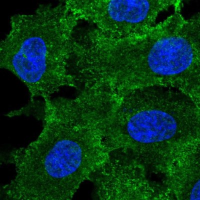 Immunocytochemistry/Immunofluorescence: MRP3 Antibody [NBP2-37923] - Immunofluorescent staining of human cell line A549 shows localization to plasma membrane.