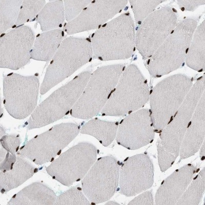 Immunocytochemistry/Immunofluorescence: NFIX Antibody [NBP2-58904] - Immunohistochemical staining of human skeletal muscle shows nuclear positivity in myocytes.
