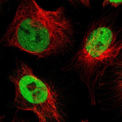 Immunocytochemistry/Immunofluorescence: NFIX Antibody [NBP2-58904] - Staining of human cell line U-251 MG shows localization to nucleoplasm.