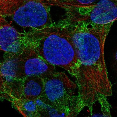 Immunocytochemistry/Immunofluorescence: PSD93 Antibody [NBP2-58558] - Staining of human cell line CACO-2 shows localization to plasma membrane.