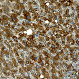 Tec was detected in immersion fixed paraffin-embedded sections of human liver using Human/Mouse Tec Monoclonal Antibody (Catalog # MAB6519) at 15 µg/mL overnight at 4 °C. Before incubation with the primary antibody, tissue was subjected to heat-induced epitope retrieval using Antigen Retrieval Reagent-Basic (Catalog # CTS013). Tissue was stained using the Anti-Mouse HRP-DAB Cell & Tissue Staining Kit (brown; Catalog # CTS002) and counterstained with hematoxylin (blue). Specific staining was localized to cytoplasm in hepatocytes. View our protocol for Chromogenic IHC Staining of Paraffin-embedded Tissue Sections.