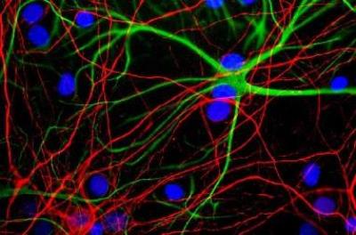 Immunocytochemistry/Immunofluorescence: NF-H Antibody (9B12) [NBP1-05210] - Mixed neuron/glial cultures stained with NBP1-05210 (red) and rabbit GFAP antibody NB300-141 (green). Axonal profiles are stained in red, while astrocytic cells are revealed in green. Nuclei are revealed with a fluorescent DNA stain (blue).
