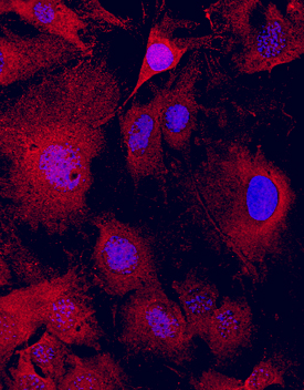 GDPD2 was detected in immersion fixed MC3T3‑E1 mouse preosteoblast cell line using Mouse Anti-Human GDPD2 Monoclonal Antibody (Catalog # MAB7026) at 10 µg/mL for 3 hours at room temperature. Cells were stained using the NorthernLights™ 557-conjugated Anti-Mouse IgG Secondary Antibody (red; Catalog # NL007) and counterstained with DAPI (blue). Specific staining was localized to cytoskeleton. View our protocol for Fluorescent ICC Staining of Cells on Coverslips.