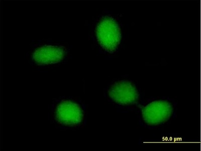 Immunocytochemistry/Immunofluorescence: FRMD8 Antibody [H00083786-B01P] - Analysis of purified antibody to FRMD8 on HeLa cell. (antibody concentration 20 ug/ml)