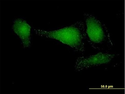 Immunocytochemistry/Immunofluorescence: DIP13B Antibody [H00055198-B01P] - Analysis of purified antibody to APPL2 on HeLa cell. (antibody concentration 10 ug/ml)