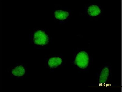 Immunocytochemistry/Immunofluorescence: RNF144A Antibody [H00009781-B02P] - Analysis of purified antibody to RNF144 on HeLa cell. (antibody concentration 10 ug/ml)