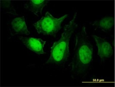 Immunocytochemistry/Immunofluorescence: Calcineurin B Antibody (4E1) [H00005534-M01] - Analysis of monoclonal antibody to PPP3R1 on HeLa cell. Antibody concentration 25 ug/ml.