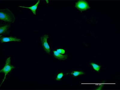Immunocytochemistry/Immunofluorescence: C8orf33 Antibody [H00065265-D01P] - Analysis of antibody to C8orf33 on HeLa cell. Antibody concentration 30 ug/ml.