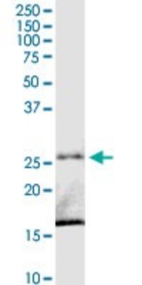 Western Blot: C8orf33 Antibody [H00065265-D01P] - Analysis of C8orf33 expression in human placenta.