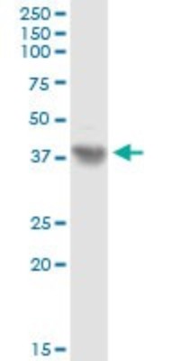 Western Blot: Asporin Antibody [H00054829-D01P] - Analysis of ASPN expression in HeLa.