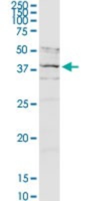 Western Blot: Asporin Antibody [H00054829-D01P] - Analysis of ASPN expression in human pancreas.