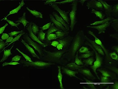 Immunocytochemistry/Immunofluorescence: CoCoA Antibody [H00057658-B01P] - Analysis of purified antibody to CALCOCO1 on HeLa cell. (antibody concentration 30 ug/ml)