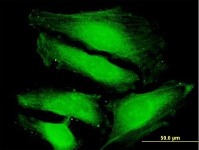 Immunocytochemistry/Immunofluorescence: TUSC4 Antibody [H00010641-B01P] - Analysis of purified antibody to TUSC4 on HeLa cell. (antibody concentration 10 ug/ml)