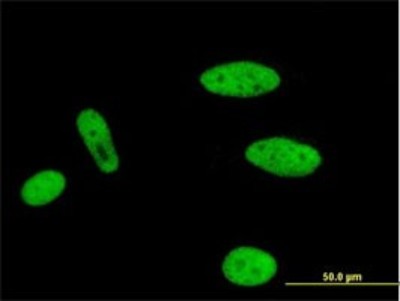 Immunocytochemistry/Immunofluorescence: MLLT1 Antibody (3H2) [H00004298-M01] - Analysis of monoclonal antibody to MLLT1 on HeLa cell. Antibody concentration 10 ug/ml.