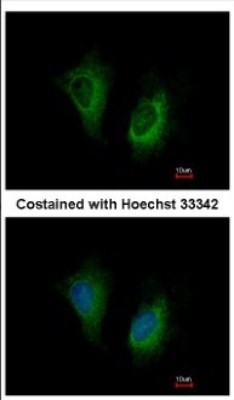 Immunocytochemistry/Immunofluorescence: MOSC2 Antibody [NBP2-19381] - Immunofluorescence analysis of methanol-fixed HeLa, using antibody at 1:200 dilution.