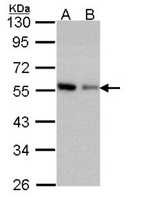 Western Blot: Coronin 3 Antibody [NBP1-31283] - Sample (30 ug of whole cell lysate) A: A431 B: H1299 10% SDS PAGE; antibody diluted at 1:1000.