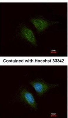 Immunocytochemistry/Immunofluorescence: Coronin 3 Antibody [NBP1-31283] - Analysis of methanol-fixed HeLa, using antibody at 1:200 dilution.
