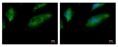 Immunocytochemistry/Immunofluorescence: CoCoA Antibody [NBP1-32154] - Sample: HeLa cells were fixed in iced-cold MeOH for 5 min. Green: CALCOCO1 protein stained by CoCoA antibody, Internal diluted at 1:500. Blue: Hoechst 33343 staining.