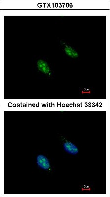 Immunocytochemistry/Immunofluorescence: RFC3 Antibody [NBP2-20134] - Analysis of paraformaldehyde-fixed HeLa, using antibody at 1:200 dilution.