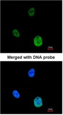 Immunocytochemistry/Immunofluorescence: SNRK Antibody [NBP1-33392] - Paraformaldehyde-fixed HeLa, using antibody at 1:200 dilution.