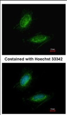 Immunocytochemistry/Immunofluorescence: UMPS Antibody [NBP2-20810] - Immunofluorescence analysis of methanol-fixed HeLa, using antibody at 1:200 dilution.
