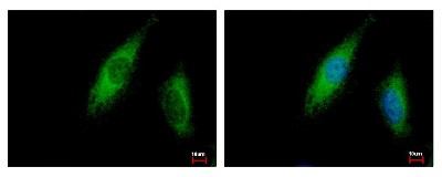 Immunocytochemistry/Immunofluorescence: ABCE1 Antibody [NBP2-15225] - Sample: HeLa cells were fixed in 2% paraformaldehyde/culture medium at 37C for 30 min. Green: ABCE1 protein stained by ABCE1 antibody diluted at 1:500. Blue: Hoechst 33342 staining.