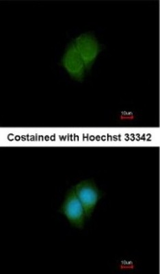 Immunocytochemistry/Immunofluorescence: ANKS3 Antibody [NBP2-15401] - Paraformaldehyde-fixed MCF-7, using antibody at 1:200 dilution.