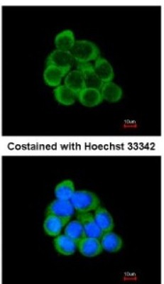 Immunocytochemistry/Immunofluorescence: PECR Antibody [NBP1-31699] - Analysis of methanol-fixed A431, using antibody at 1:200 dilution.