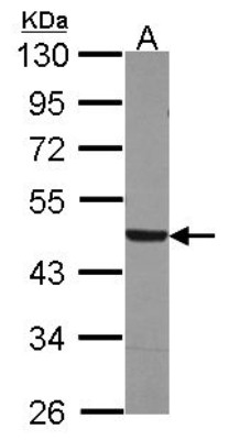 Western Blot: Asporin Antibody [NBP2-15492] - Sample (30 ug of whole cell lysate) A: HCT116 10% SDS PAGE gel, diluted at 1:1000.