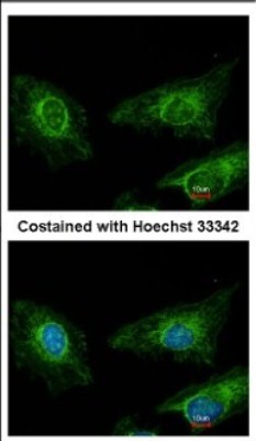 Immunocytochemistry/Immunofluorescence: Asporin Antibody [NBP2-15492] - Immunofluorescence analysis of methanol-fixed HeLa, using antibody at 1:200 dilution.