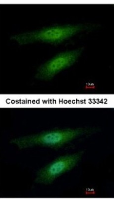 Immunocytochemistry/Immunofluorescence: MSH3 Antibody [NBP2-19417] - Analysis of paraformaldehyde-fixed HeLa, using antibody at 1:500 dilution.