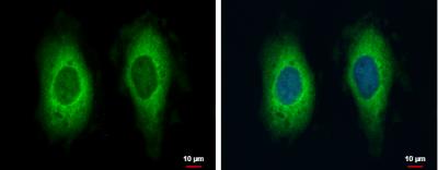 Immunocytochemistry/Immunofluorescence: RAE1 Antibody [NBP1-31027] - HeLa cells were fixed in 4% paraformaldehyde at RT for 15 min. Green: RAE1 protein stained by RAE1 antibody [C3], C-term diluted at 1:500.Blue: Hoechst 33342 staining.