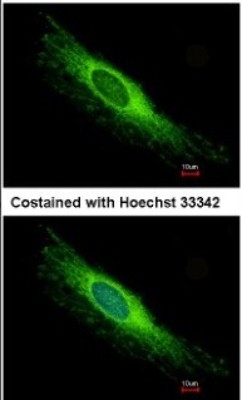 Immunocytochemistry/Immunofluorescence: PEX26 Antibody [NBP1-32743] - Analysis of methanol-fixed HeLa, using antibody at 1:500 dilution.